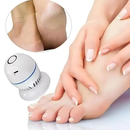 Removedor de Callos Eléctrico Recargable — Pies Suaves al Instante sin Esfuerzo — SoftFeet™ — ✨🦶⚡