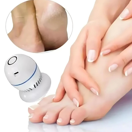 Removedor de Callos Eléctrico Recargable — Pies Suaves al Instante sin Esfuerzo — SoftFeet™ — ✨🦶⚡